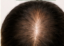 Hair Oil before visual example