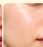 Herbal Serum after visual example