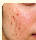 Herbal Serum before visual example